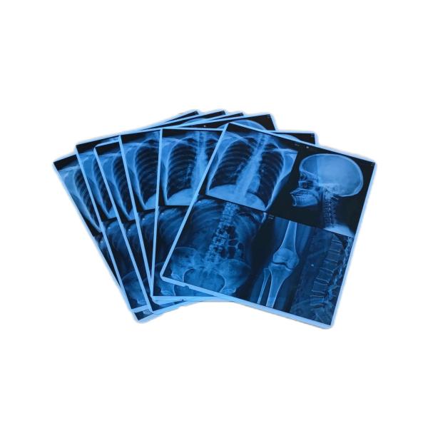 High Image Stability Blue Medical Film Inkjet For Inkjet X Ray Film