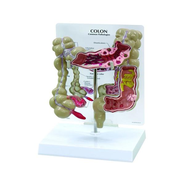 Advanced Medical Human Large Intestine Anatomy Model For School Hospital