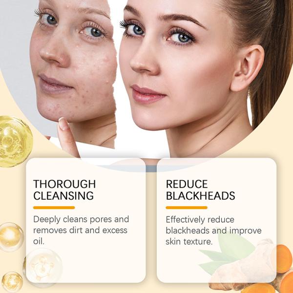 OEM Etiqueta privada Ácido cójico limpia y clara piel aclarador espumante lavado facial limpiador de espuma de cúrcuma para manchas oscuras Acné