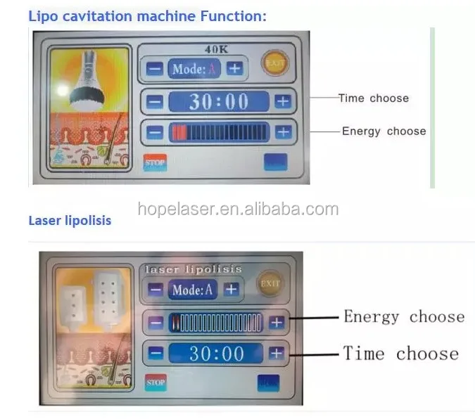 High quality 8 Pads Diode Lipo Laser LLLT Ultrasonic 40K Cavitation Slimming Vacuum RF Cellulite Weight Loss Machine