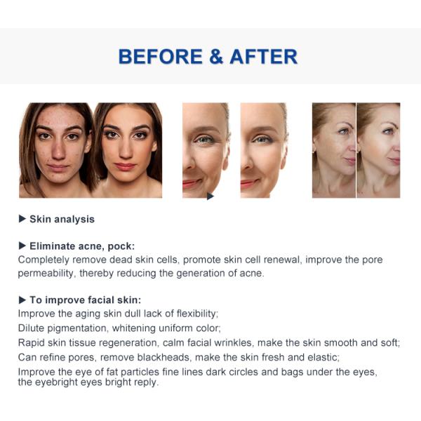 7 Probes Beauty Hydro Microdermabrasion Machine Oxygen Hydro Jet Peel Therapy