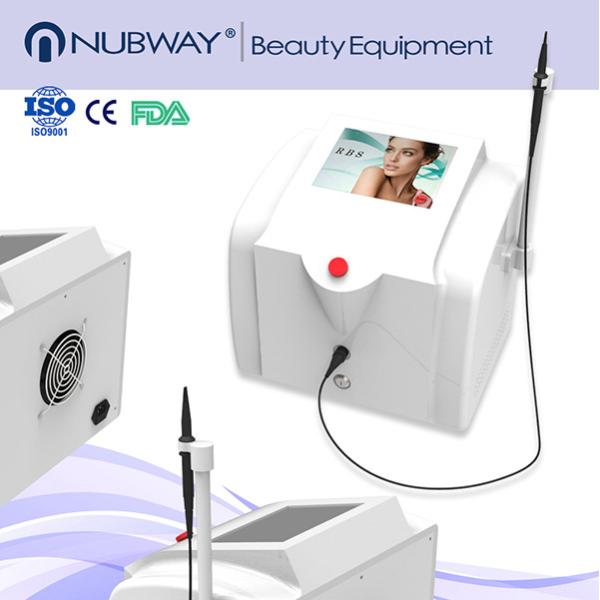 High frequency machine facial vein treatment with immediate obvious effect