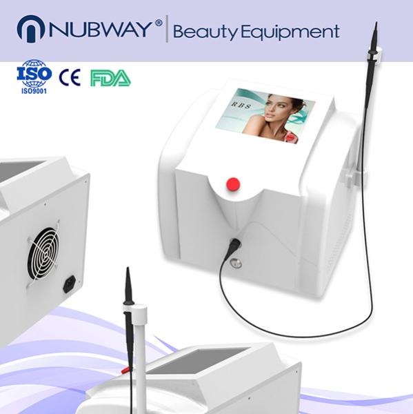 High frequency machine facial vein treatment with immediate obvious effect