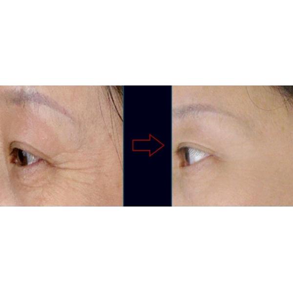 Small gas bubble water machine for salon / peel remove, facial machine Small gas bubble water face peeling face care