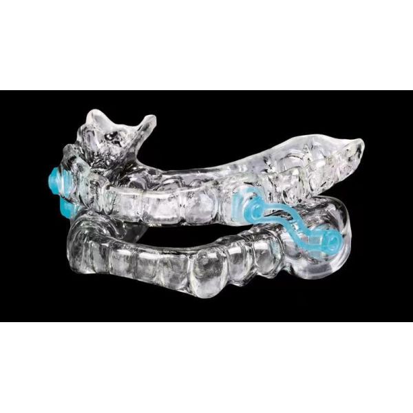 Custom Anti-Snoring Device - Medical-Grade Thermoplastic Mandibular Advancement Device for Snoring and Sleep Apnea