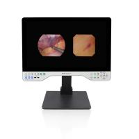 Système d'endoscopie 1080P Full HD Rigid et flexible 24 pouces tout en un appareil photo d'enregistrement vidéo