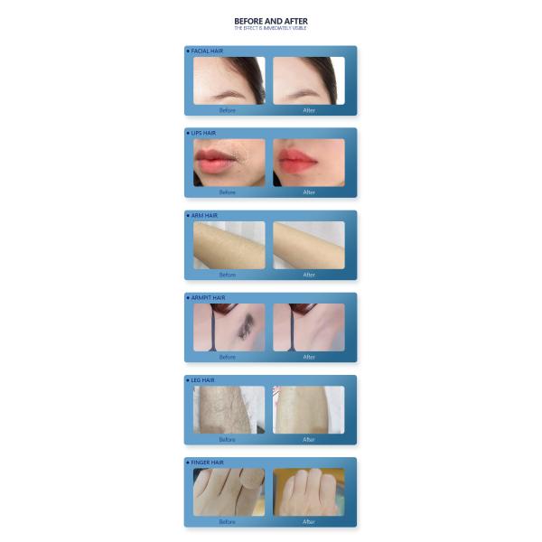 удаление волос лазера льда сопрано машины 3500В лазера диода 400мс 808нм