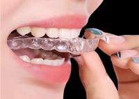 Appareils orthodontiques pour un traitement rapide et efficace