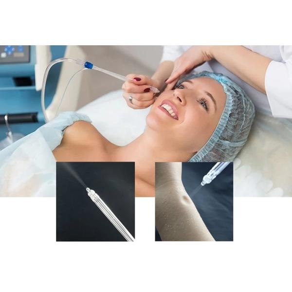Get a Clean and Glowing Face with Our CE Certified Oxygen Jet Peel Facial Machine