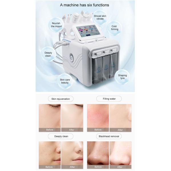 кислород 6 водопода 350W в 1 вызревании удаления морщинки Dermabrasion гидры анти-