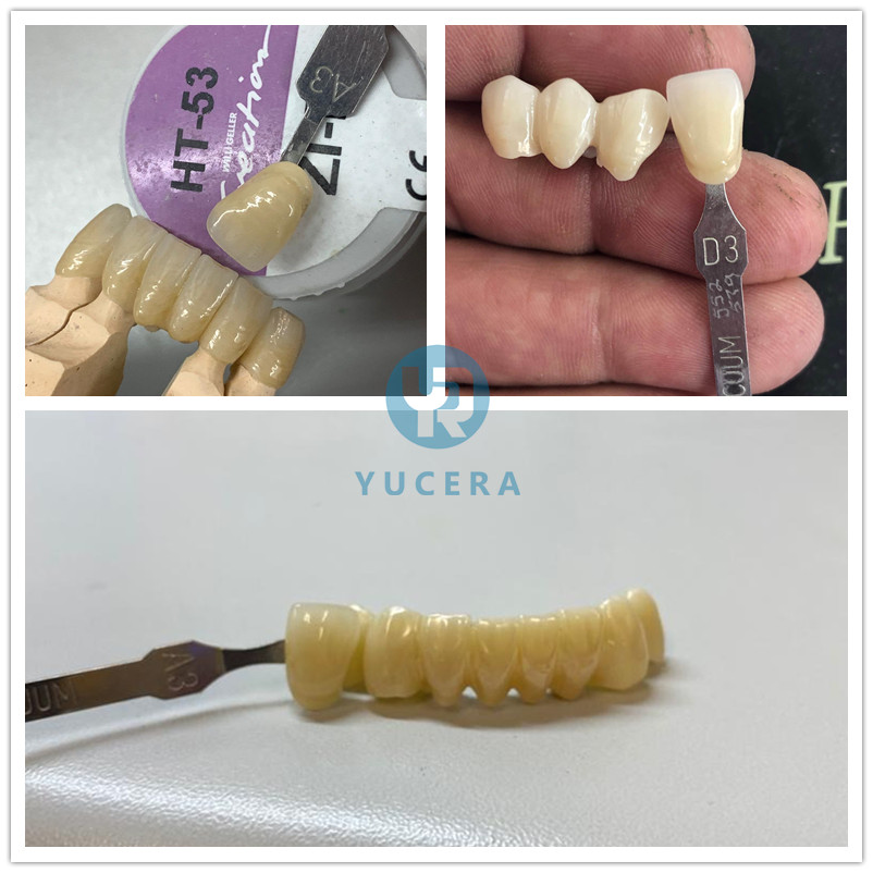 Диск пробела блока Zirconia A1 A2 A3 3d разнослоистый для Laboratorio зубоврачебного