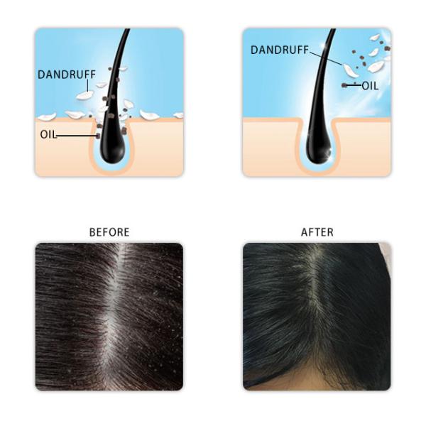 ANTI-DANDRUFF SHAMPOO NOURISH SHAMPOO OIL-CONTROL SHAMPOO 500ML PET BOTTLE