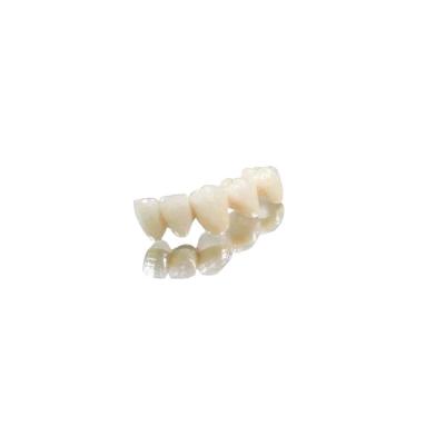Fit Properly Crown And Bridge Teeth Cobalt Chromium Full Metal Crown