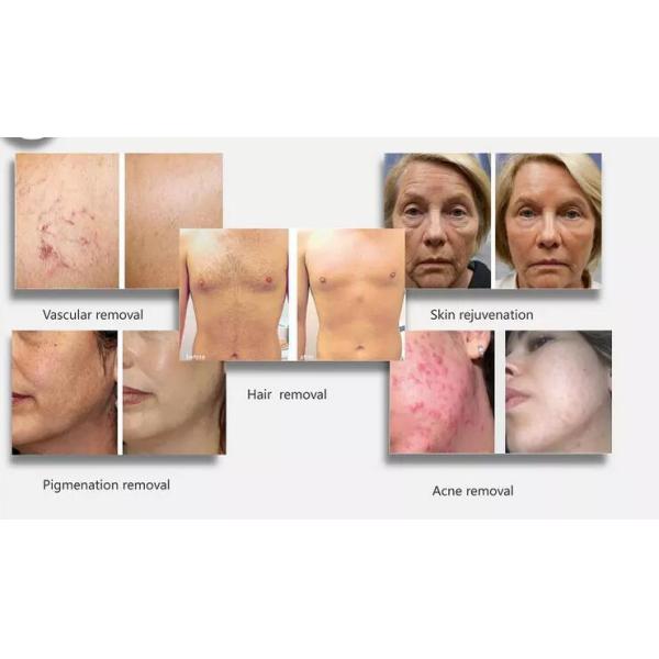 OPT SHR Hair Removal Machine , Small Elight IPL RF Beauty Equipment