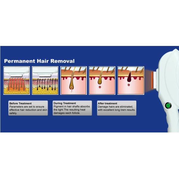 Hair Removal IPL Laser Machine