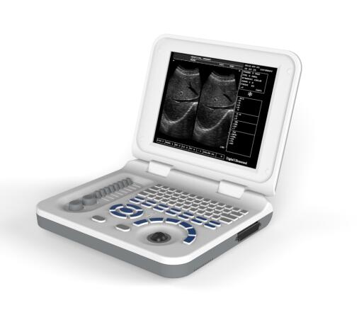 Hospital Equipment Portable Ultrasound Machine With 10.4 Inch LED Displayer