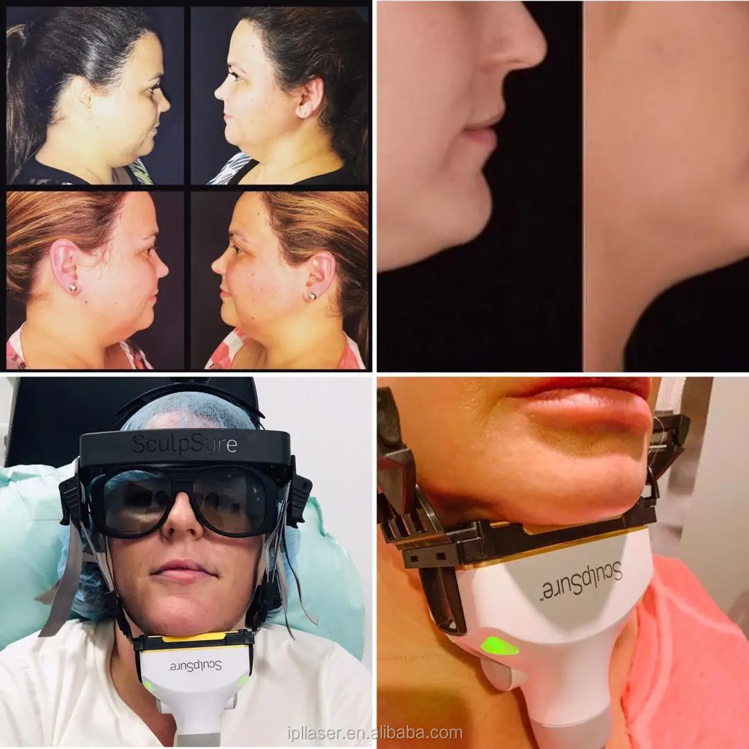 1060nm diode laser sculpsure body contouring fat freezing slimming system for fat loss