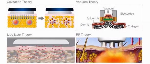 3 в 1 машине красоты электрической горячей холодной лицевой кожи Массагер поднимаясь