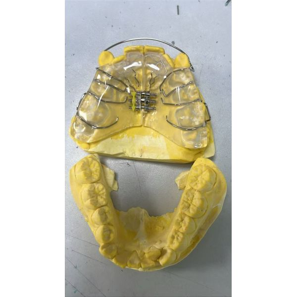 Customized Orthodontic Appliances and Dental Aligners with Digital Design and Medical-Grade Thermoplastic