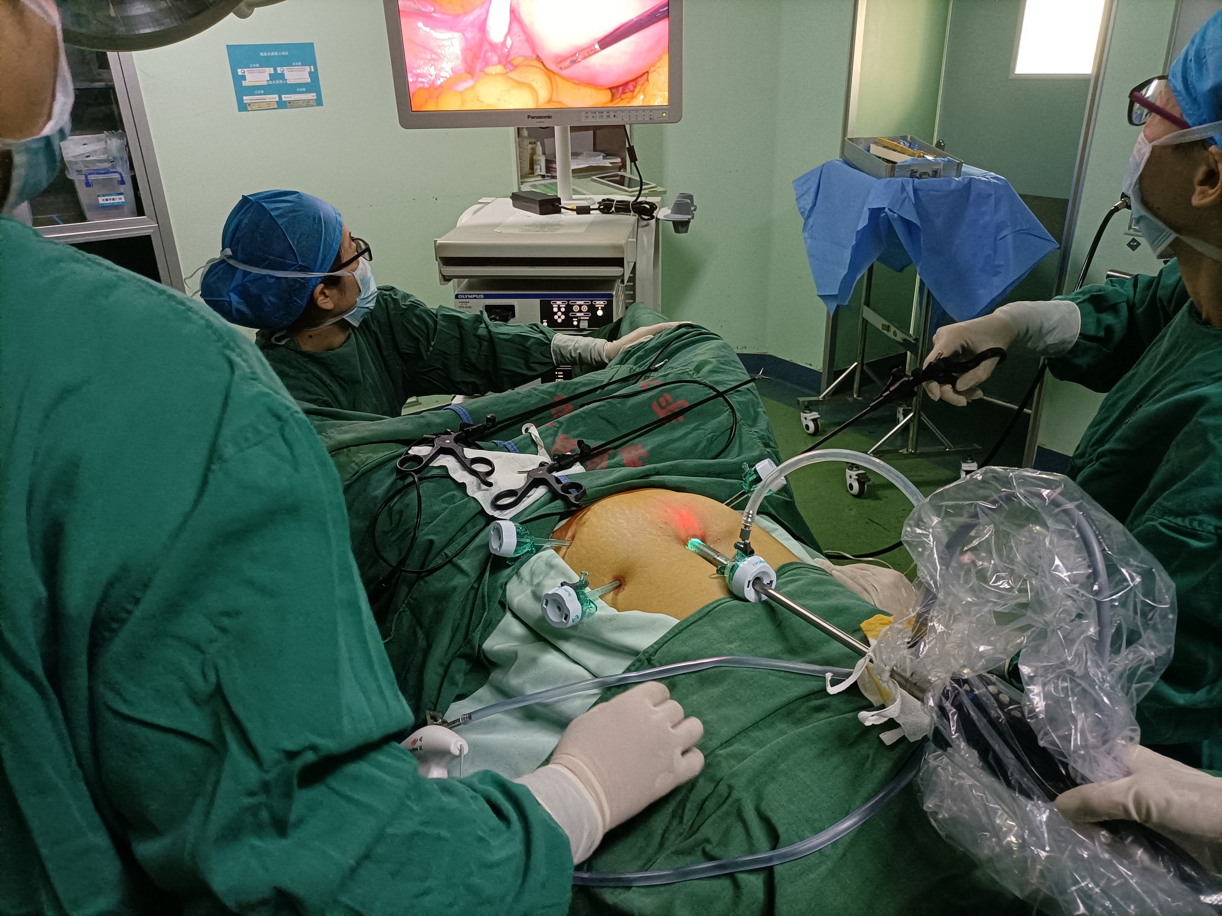 Нержавеющая сталь EO Trocar визуальной подсказки устранимая Laparoscopic