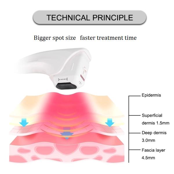 High Intensity Focused Ultrasound HIFU Face Tightening Machine Wrinkle Removal Ultrasonic Beauty Machine