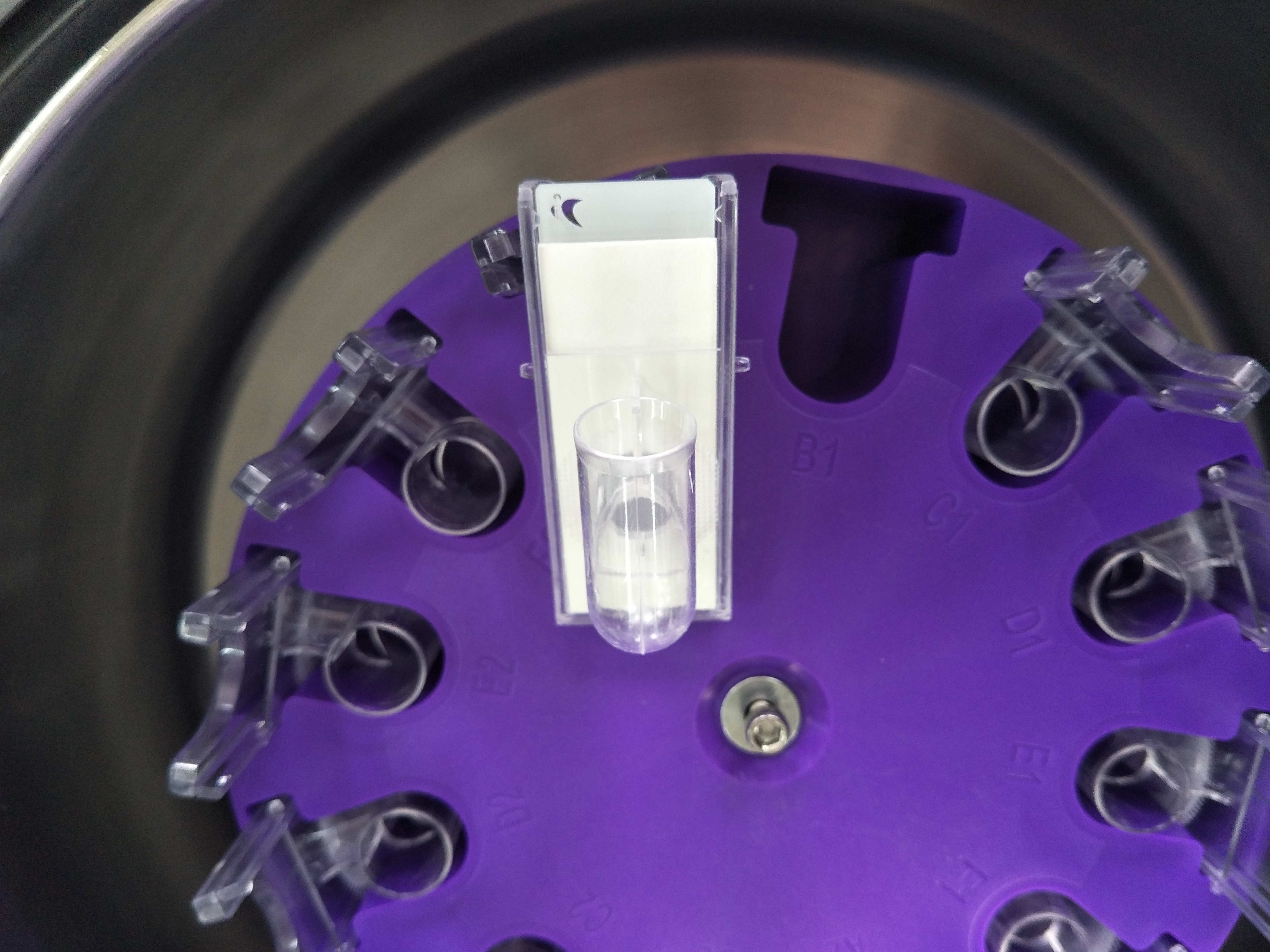 Cytospin 3000rpm Automatic Laboratory Centrifuge for Cell Smear Smearing 12 Slides of CSF Urine Pleural Fluid