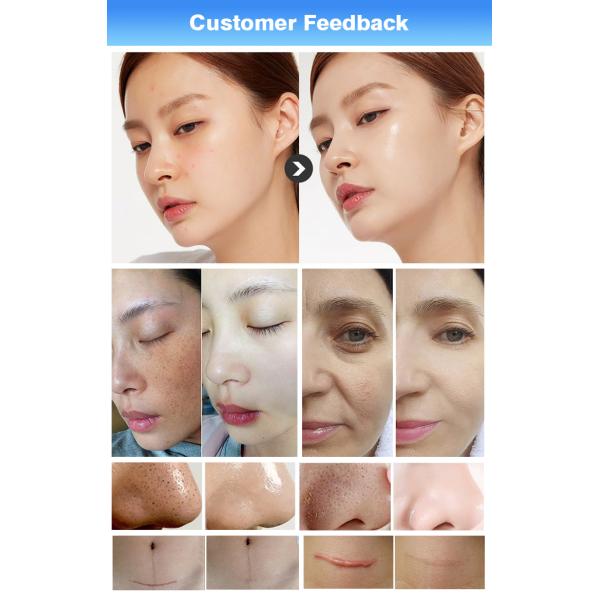 15 In 1 Beauty Spa Hydra Dermabrasion Machine For Facial Skin Care