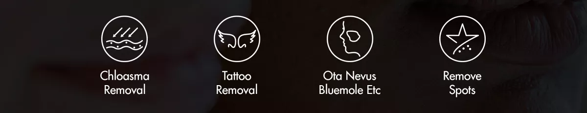 машина лазера pico Оборудование красоты лазер Mahcine пикосекунды обработки пигмента машины удаления татуировки лазера 1064+532 пикосекунд вертикальный