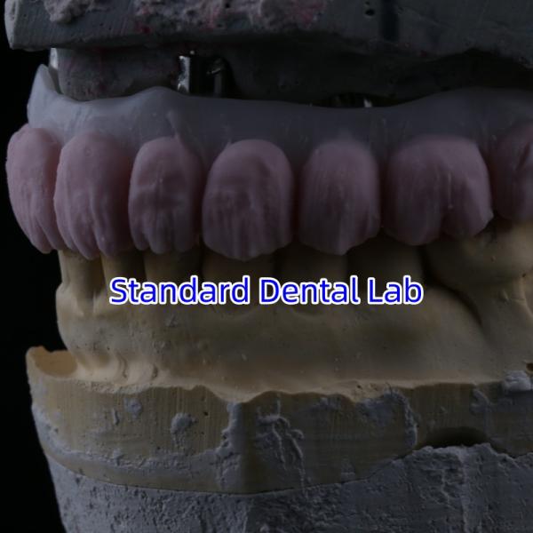 Porcelain All On Four Zirconia Bridge High Esthetics Dental Implant Bridge