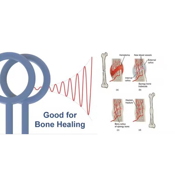 Pulsed Electromagnetic Field Reduce Inflammation Physio Magneto Pemf Magnetic Therapy Device Horse Human