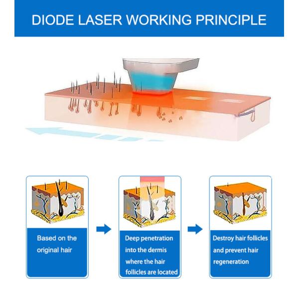 Triple Wavelength Laser Hair Removal Machine 755nm 808nm 1064nm With Wind Cooling System