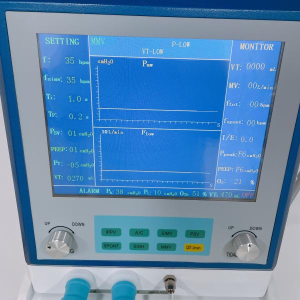 Машина вентилятора ГБ/Т18830 дыша для операции ИКУ медицинской хирургической