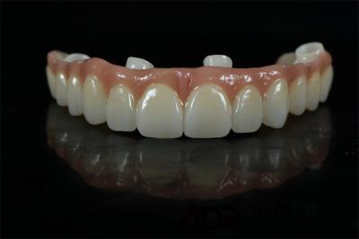 Precise Dental Implants Crowns And Bridges Custom Abutment