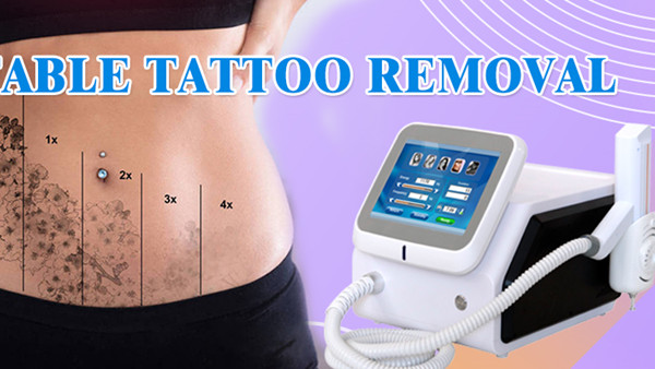 Máquina portátil de eliminación de tatuajes con láser Nd YAG 1064nm 532nm 1320nm