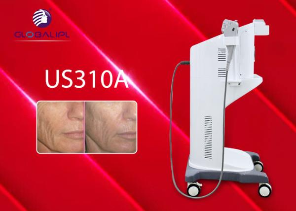 Non Invasive Hifu Facelift Machine Face Wrinkle Remover Machine 4.0 MHz