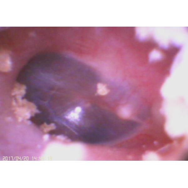 720X480 Otoscopio de vídeo digital