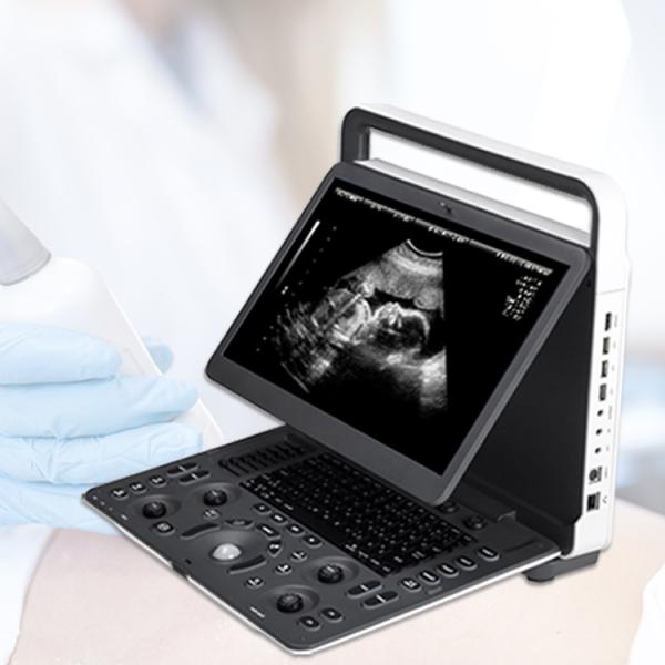E2V Veterinary Ultrasound Doppler Color Sonoscape E2