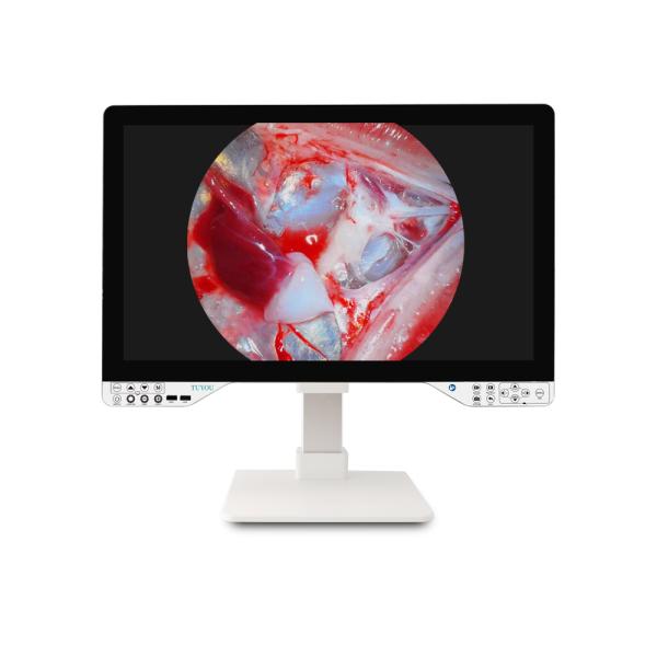 27 FHD Endoscope Camera System for Gynecology with LED Light Source