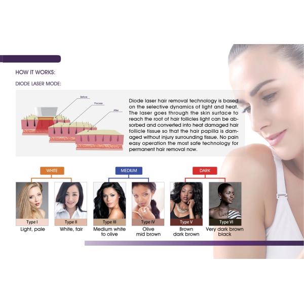 OEM Painless FAC Tech 808 Diode Laser Machine Vertical Permanent