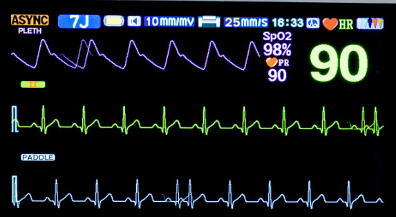 Portable Biphasic Defibrillator With ECG & Printer Li-ion Battery Opt. AED, Pacer, SpO2