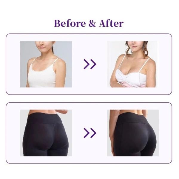 Injeção ácida hialurónica do Ha do enchimento da ampliação coreana das nádegas da expansão do peito para o corpo