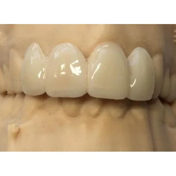 1050 Mpa многослойный цирконий зубной материал CAD CAM для стоматологической лаборатории