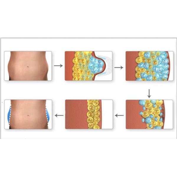 Машина Cryolipolysis крутой волны жирная замерзая на облегчение боли 1-16 Hz частоты
