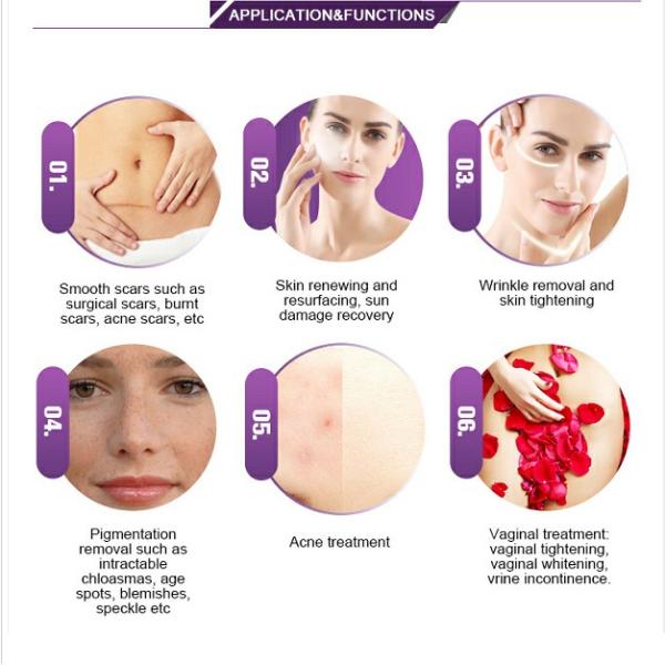 Углекислый диоксид лазерная фракционная CO2 машина для осветления и затягивания кожи