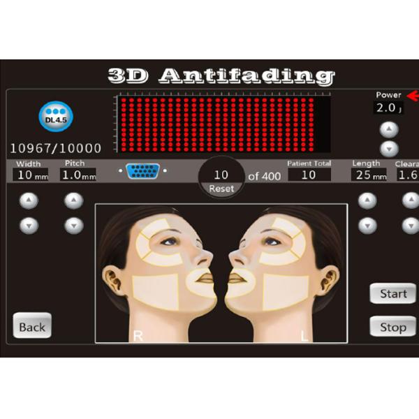 20000 патронов машины 8 подтяжки лица съемок 3Д Хифу не хирургических с 1-11 выравниваются