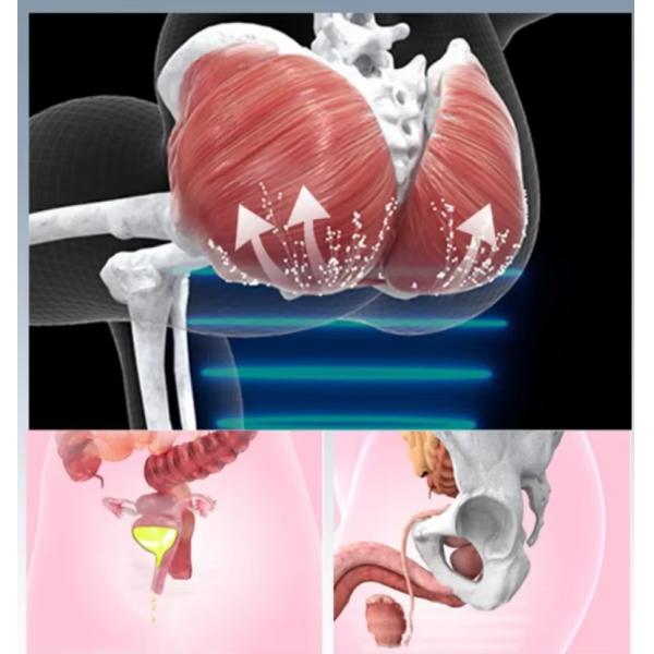 Stimulateur musculaire pour la perte de poids, le corps et les muscles du plancher pelvien