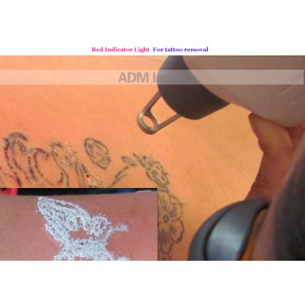 1064 Nm Q Switch ND YAG Laser Machine For Pigmentation Tatoo Removal Laser Treatment