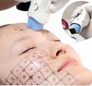Portable Thermage 40.68Mhz Hifu Beauty Machine