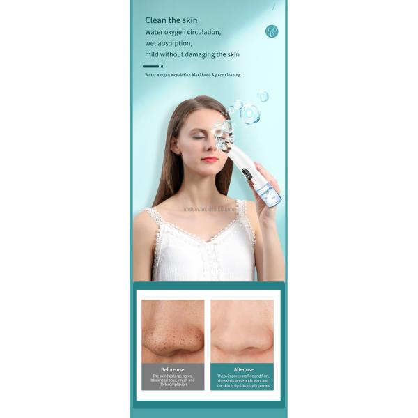 Powerful Blackhead Eliminator Vacuum Blackhead Remover Water Tank Separation Hot Item