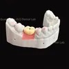 Dental Lab Durability Implants Make Cost-Effective Option in The Long Run